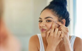 home remedies for skin problems