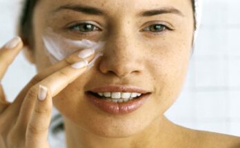 pigmentation