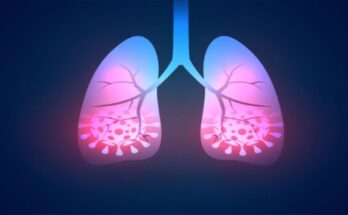 seo-blog-covid-and-lungs