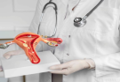 How a Cervical Cancer Diagnosis Can Affect Fertility