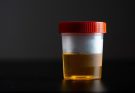 What Your Urine Colour Says About Your Health